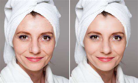 AddressingSpecificConcerns:Dryness,Wrinkles,andAgeSpots
