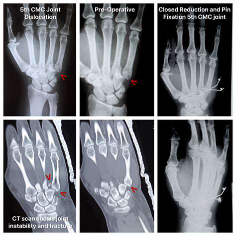KeyPrinciplesofHandFractureRehabilitation:AMultifacetedApproach