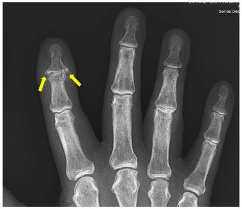 Techniques for Reducing Chronic Hand Inflammation